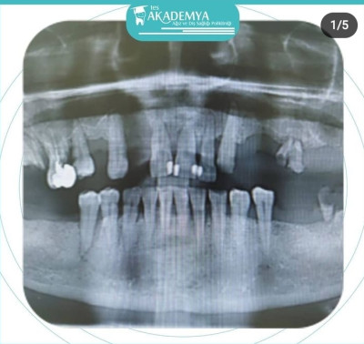 Oral Diagnoz ve Radyoloji nedir?