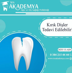 Kırık diş nasıl tedavi edilir? - Türkiye Diş Hastahanesi