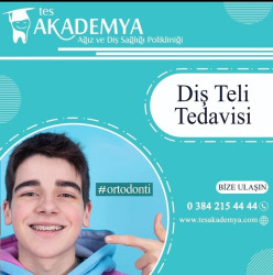 Türkiye Diş Teli Tedavisi