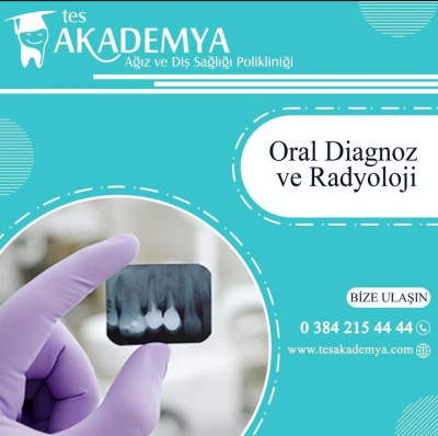Oral Diagnoz ve Radyoloji - Kapadokya Diş Hastahanesi