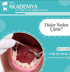 Dişler neden çürür?