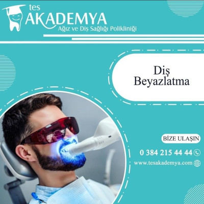 Diş Beyazlatma nedir? Diş Beyazlatma kaç usd? Türkiye'de diş beyazlatma yaptırma?