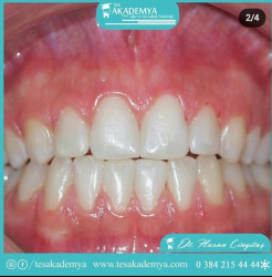 #Orthodontics #successfully #applied  #Oral #Heal