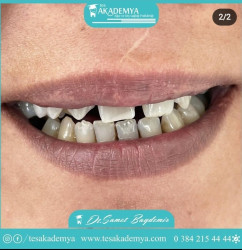 #hospital #dental #treatment #Contemporary #treatmentmethods  #TeethWhitening #Implant #Surgical #Tooth #Extraction #AestheticFilling #Zirconium #Coating #Orthodontics #successfully #applied  #Oral #Health