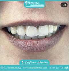 #dental #treatment #Contemporary #treatmentmethods  #TeethWhitening #Implant #Surgical #Tooth #Extraction #AestheticFilling #Zirconium #Coating #Orthodontics #successfully #applied  #Oral #Health