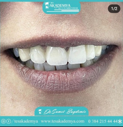 #dental #treatment #Contemporary #treatmentmethods  #TeethWhitening #Implant #Surgical #Tooth #Extraction #AestheticFilling #Zirconium #Coating #Orthodontics #successfully #applied  #Oral #Health