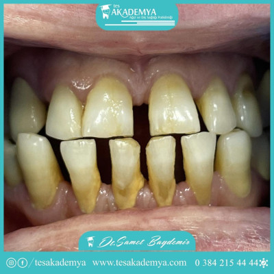 #dental #treatment #Contemporary #treatmentmethods  #TeethWhitening #Implant #Surgical #Tooth #Extraction #AestheticFilling #Zirconium #Coating #Orthodontics #successfully #applied  #Oral #Heal