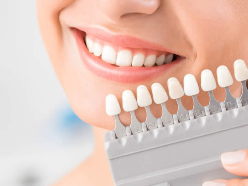 Turkey Zirconium Dental Veneers - 2Days