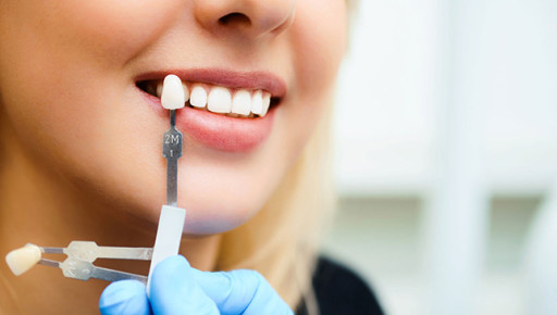 Cappadocia Zirconium Dental Veneers - 2Days