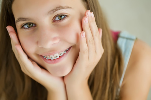 Turkey Orthodontic Braces Treatment 1Days