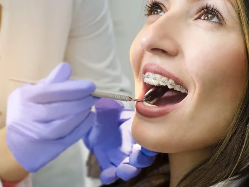 Turkey Orthodontic Braces Treatment 1Day