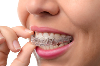 braces treatment teeth straightening ortodonti tur
